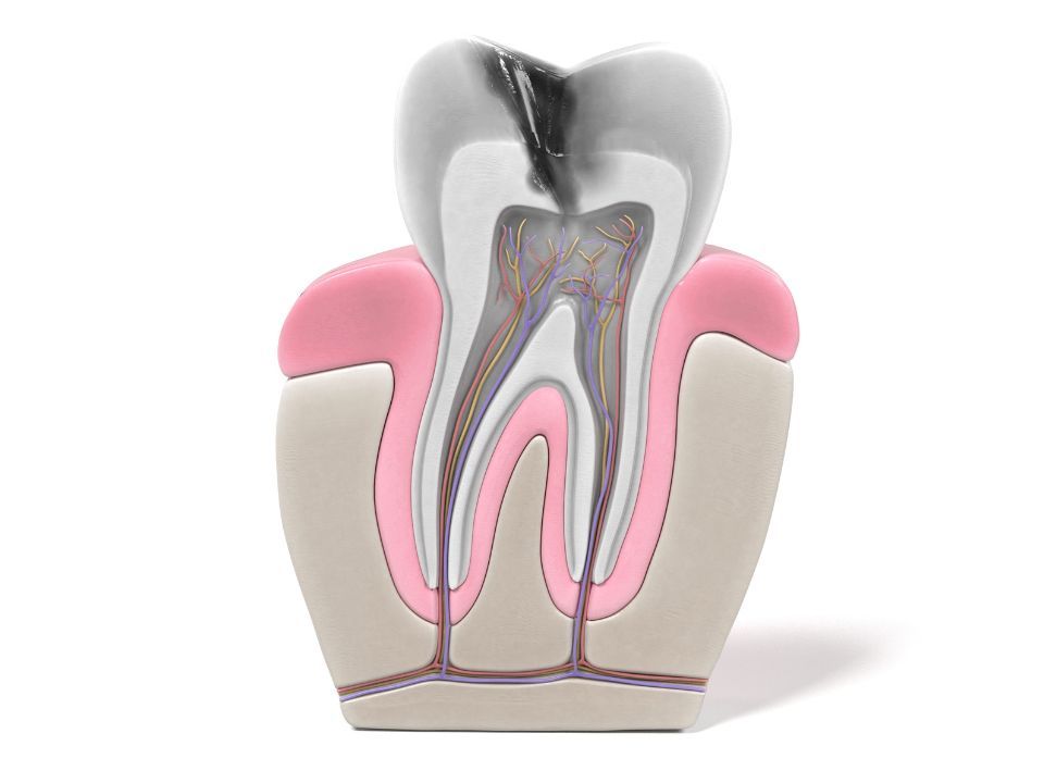 endodontie.jpg