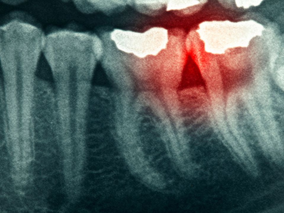 odontoterapie.jpg